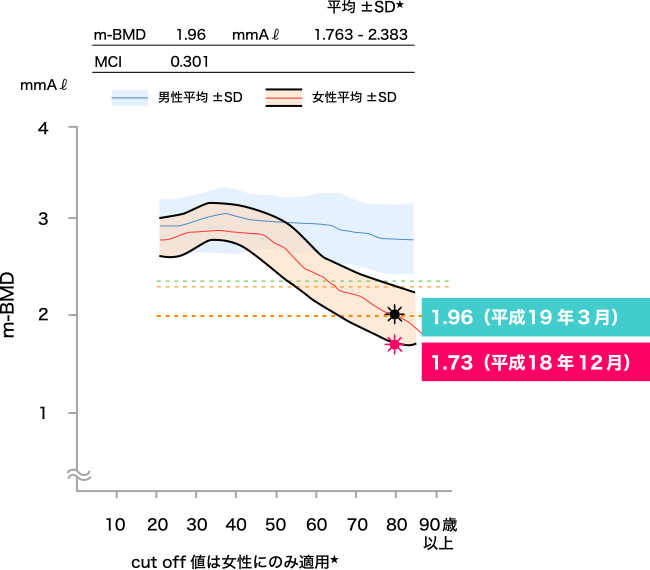 図1. 吸収型Q10（包接体）とビタミンCを配合したサプリメント摂取による骨密度の変化（その1）N.K（79歳女性）