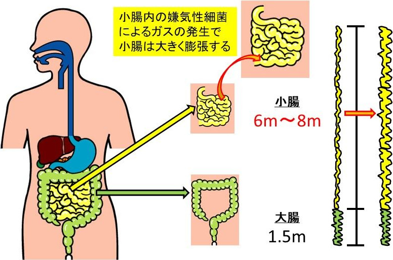 図1. 小腸と大腸の長さ、そして、SIBOによる小腸の膨張